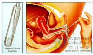 人工受精過程圖解