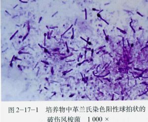 破傷風桿菌