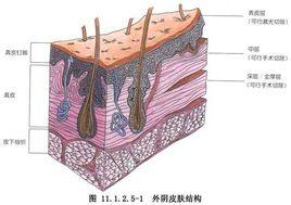 單純女陰切除術