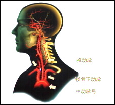 短暫性大腦缺血性發作