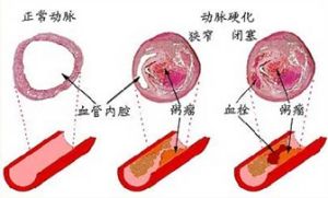 心血管