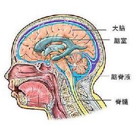 低顱壓綜合症