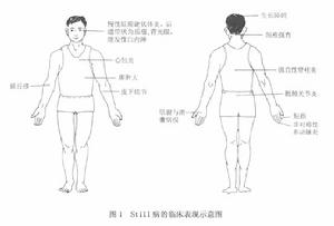 （圖）still病臨床表現示意圖