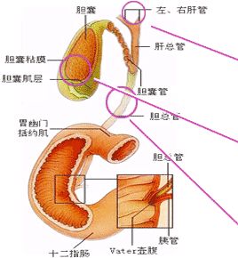 膽管結石