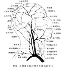 腦循環示意圖2