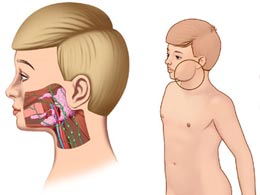 化膿性腮腺炎