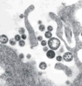 拉沙熱病毒電鏡掃描圖