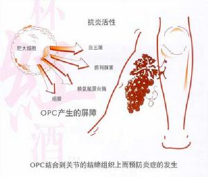 （圖）預防和緩解關節炎