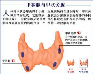 甲狀旁腺功能減退性心肌病