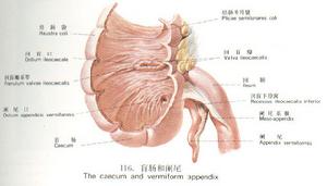 闌尾寄生蟲病