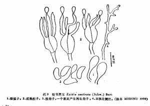 結節黑耳