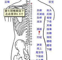 胸背肌筋膜炎