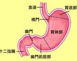 幽門狹窄