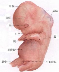新生兒肛門和直腸畸形