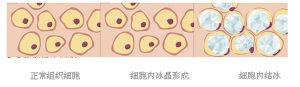 當溫度進一步降低至-21℃～-175℃時，細胞內形成冰晶