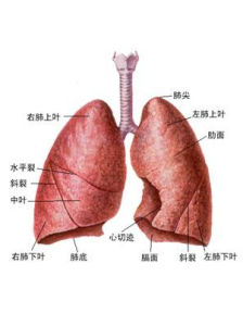 新生兒呼吸窘迫綜合徵