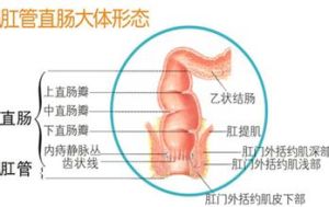 直腸炎