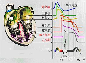 室性並行心律及室性並行心律性心動過速