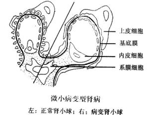 尿常規檢查