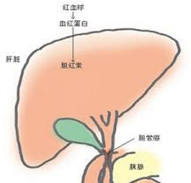 膽紅素升高