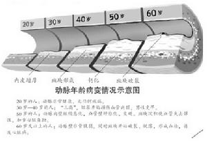 動脈年齡