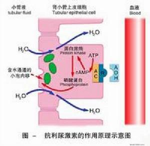 抗利尿激素分泌異常綜合症