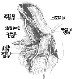 法樂四聯症