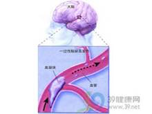 無症狀性腦梗死