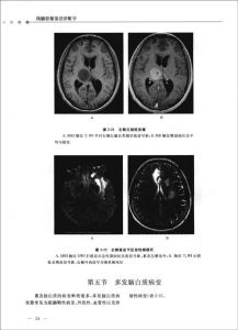 《顱腦影像鑑別診斷學》