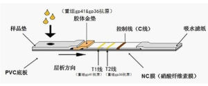 愛滋病