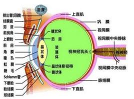 晶狀體抗原性葡萄膜炎