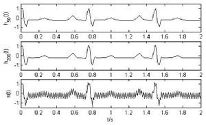 附圖2 純淨的心跳曲線和有污染的心跳曲線