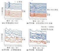 糖尿病性胃輕癱