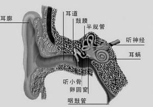 暴聾病