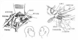 自發性蛛網膜下腔出血