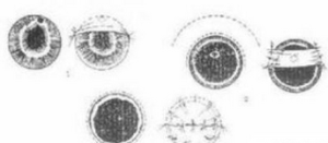 反應性穿孔性膠原病