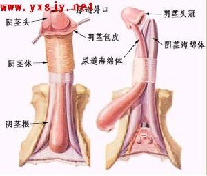 陰莖彎曲矯正術