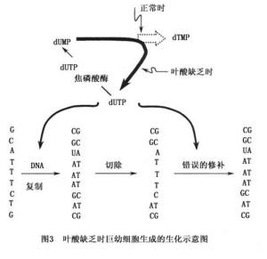 巨幼細胞性貧血