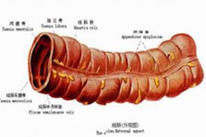 妊娠合併自身免疫性溶血性貧血