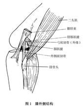 膝外側韌帶損傷