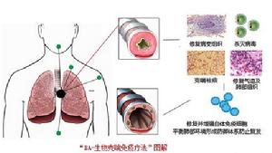 BA-生物克喘免疫療法