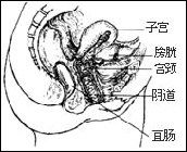 肛門直腸損傷