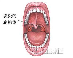 頭孢乙氰鈉