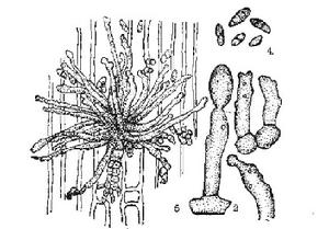 芽孢狀枝孢霉