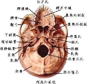 顱底陷入