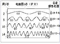 腦波示意圖