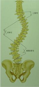 脊柱側凸畸形