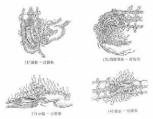 小兒便血