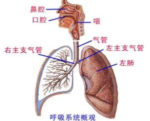 呼吸窘迫綜合徵