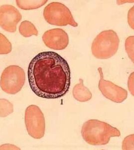 紅細胞生成性卟啉病